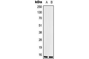 Western blot analysis of LSM1 expression in Hela (A), HEK293T (B) whole cell lysates. (LSM1 Antikörper  (Center))