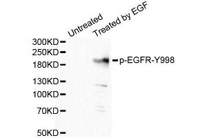 Western Blotting (WB) image for anti-Epidermal Growth Factor Receptor (EGFR) (pTyr998) antibody (ABIN1870110) (EGFR Antikörper  (pTyr998))