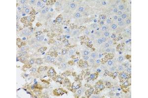 Immunohistochemistry of paraffin-embedded Rat liver using TROVE2 Polyclonal Antibody at dilution of 1:100 (40x lens). (TROVE2 Antikörper)