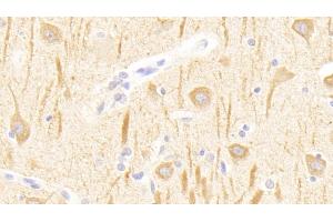 Detection of GRM1 in Human Cerebrum Tissue using Polyclonal Antibody to Glutamate Receptor, Metabotropic 1 (GRM1) (Metabotropic Glutamate Receptor 1 Antikörper  (AA 165-592))