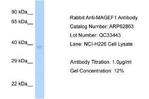 Western Blotting (WB) image for anti-Melanoma Antigen Family F, 1 (MAGEF1) (C-Term) antibody (ABIN2789272) (MAGEF1 Antikörper  (C-Term))