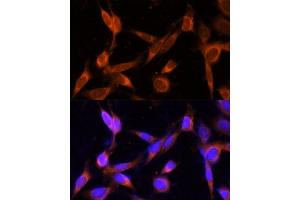Immunofluorescence analysis of NIH-3T3 cells using VMP1 Polyclonal Antibody (ABIN7271283) at dilution of 1:100 (40x lens). (VMP1 Antikörper  (C-Term))