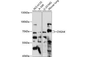 Western blot analysis of extracts of various cell lines, using CNG antibody (ABIN7266548) at 1:1000 dilution. (CNGA4 Antikörper  (AA 416-575))