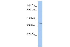 FAM78A antibody used at 1 ug/ml to detect target protein.