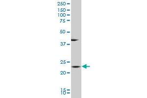 BLVRB polyclonal antibody (A01), Lot # 060104JC01 Western Blot analysis of BLVRB expression in K-562 . (BLVRB Antikörper  (AA 107-206))