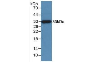 Western blot analysis of recombinant Human NAGase. (MGEA5 Antikörper  (AA 6-240))