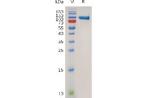 SDS-PAGE (SDS) image for Matrix Metallopeptidase 9 (Gelatinase B, 92kDa Gelatinase, 92kDa Type IV Collagenase) (MMP9) (AA 20-707) protein (His tag) (ABIN7490939)