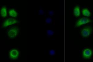 Detection of IL31RA in Human MCF7 cell using Polyclonal Antibody to Interleukin 31 Receptor A (IL31RA) (IL31RA Antikörper  (AA 205-456))