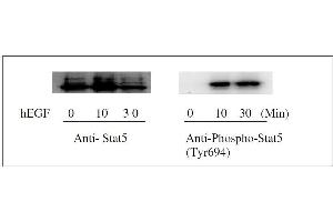 Western Blotting (WB) image for Signal Transducer and Activator of Transcription 5A (STAT5A) ELISA Kit (ABIN1981843)