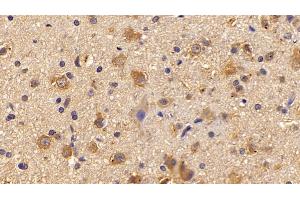 Detection of PNMA2 in Rat Cerebrum Tissue using Polyclonal Antibody to Paraneoplastic Antigen MA2 (PNMA2) (PNMA2 Antikörper  (AA 74-333))