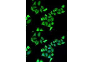 Immunofluorescence analysis of A549 cells using GALE antibody. (GALE Antikörper)