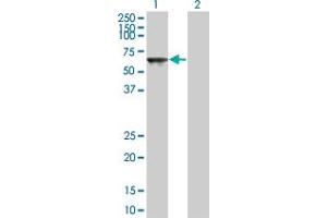 Western Blot analysis of TOE1 expression in transfected 293T cell line by TOE1 monoclonal antibody (M03A), clone 1D4. (TOE1 Antikörper  (AA 1-510))
