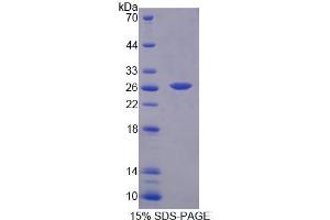 SDS-PAGE analysis of Mouse BCAT1 Protein. (BCAT1 Protein)