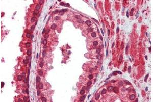 Immunohistochemistry (Paraffin-embedded Sections) (IHC (p)) image for anti-Activating Transcription Factor 4 (Tax-Responsive Enhancer Element B67) (ATF4) (N-Term) antibody (ABIN462203)