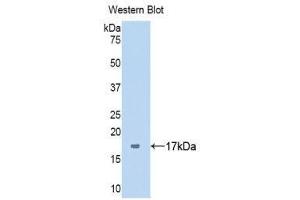 Western Blotting (WB) image for anti-Serpin Peptidase Inhibitor, Clade G (C1 Inhibitor), Member 1 (SERPING1) (AA 399-500) antibody (ABIN1858184) (SERPING1 Antikörper  (AA 399-500))