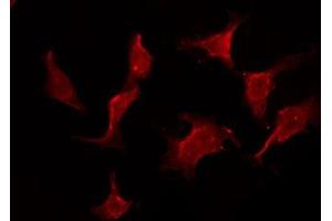 ABIN6275769 staining HeLa by IF/ICC. (IL11RA Antikörper  (C-Term))