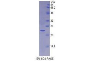 SDS-PAGE (SDS) image for TIMP Metallopeptidase Inhibitor 4 (TIMP4) (AA 42-224) protein (His tag) (ABIN2122236)