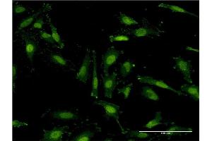 Immunofluorescence of monoclonal antibody to RNF40 on HeLa cell. (RNF40 Antikörper  (AA 102-200))
