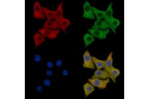 PDGF Receptor alpha Mouse Monoclonal Antibody staining HepG2 cells by IF/ICC.