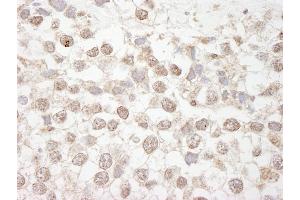 Immunohistochemistry (IHC) image for anti-Methyl-CpG Binding Domain Protein 4 (MBD4) (AA 1-50) antibody (ABIN7448644)