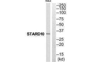 Western Blotting (WB) image for anti-StAR-Related Lipid Transfer (START) Domain Containing 10 (STARD10) (N-Term) antibody (ABIN1852528) (STARD10 Antikörper  (N-Term))