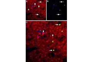 Expression of neuropeptide Y5 receptor in rat striatum - Immunohistochemical staining of rat striatum using Anti-NPY5R Antibody (ABIN7043375 and ABIN7044673). (NPY5R Antikörper  (AA 291-306))