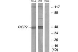 Western blot analysis of extracts from HeLa/293 cells, using CtBP2 Antibody.