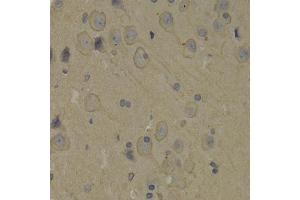 Immunohistochemistry of paraffin-embedded rat brain using PIK3R1 antibody. (PIK3R1 Antikörper)