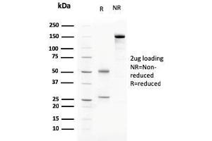 SDS-PAGE Analysis Purified C1QA Mouse Monoclonal Antibody (C1QA/2783). (C1QA Antikörper  (AA 104-237))
