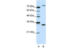 WB Suggested Anti-EXOSC2  Antibody Titration: 1. (EXOSC2 Antikörper  (N-Term))