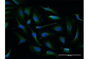 Immunofluorescence of purified MaxPab antibody to NQO2 on HeLa cell. (NQO2 Antikörper  (AA 1-231))