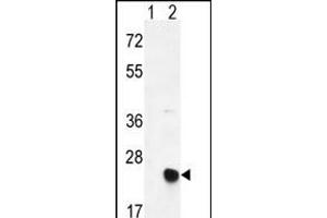Western blot analysis of MSRB2 (arrow) using rabbit polyclonal MSRB2 Antibody (Center) (ABIN390968 and ABIN2841148).