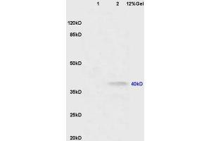 Lane 1: mouse lung lysates Lane 2: mouse brain lysates probed with Anti CNR2/CB2 Polyclonal Antibody, Unconjugated (ABIN680168) at 1:200 in 4 °C.