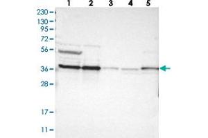 Western blot analysis of Lane 1: RT-4, Lane 2: U-251 MG, Lane 3: Human Plasma, Lane 4: Liver, Lane 5: Tonsil with CALHM2 polyclonal antibody . (CALHM2 Antikörper)
