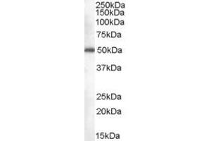 Western Blotting (WB) image for anti-CDK5 Regulatory Subunit Associated Protein 3 (CDK5RAP3) (C-Term) antibody (ABIN2774329) (CDK5RAP3 Antikörper  (C-Term))