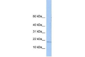 ZNHIT3 antibody used at 0. (ZNHIT3 Antikörper  (N-Term))