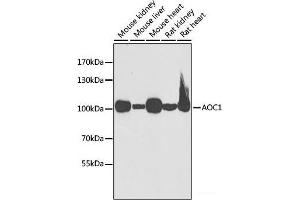 Western blot analysis of extracts of various cell lines using AOC1 Polyclonal Antibody at dilution of 1:1000. (DAO Antikörper)