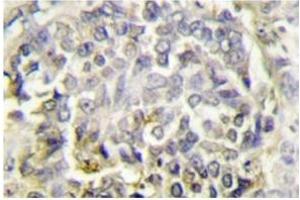 Image no. 1 for anti-PYD and CARD Domain Containing (PYCARD) antibody (ABIN272291) (PYCARD Antikörper)
