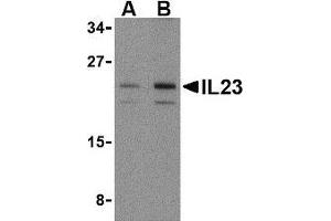 Western blot analysis of IL-23 in mouse pancreas tissue lysate with AP30419PU-N IL-23 antibody at (A) 1 and (B) 2 μg/ml. (IL23A Antikörper  (N-Term))