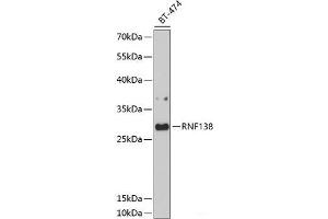 Western blot analysis of extracts of BT-474 cells using RNF138 Polyclonal Antibody at dilution of 1:1000. (RNF138 Antikörper)