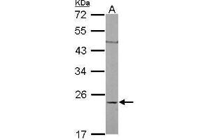 Western Blotting (WB) image for anti-Ras Homolog Gene Family, Member C (RHOC) antibody (ABIN2854791)