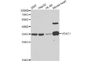 Western blot analysis of extracts of various cell lines, using VDAC1 antibody. (VDAC1 Antikörper  (AA 1-283))