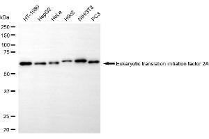 Western blotting analysis using eukaryotic translation initiation factor 2A antibody (ABIN7798513). (Rekombinanter EIF2A Antikörper)