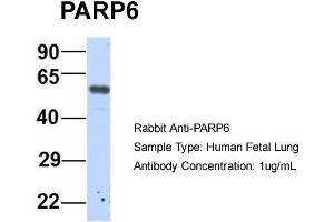 Host:  Rabbit  Target Name:  P Sample Type:  Human Fetal Lung  Antibody Dilution:  1. (PARP6 Antikörper  (N-Term))