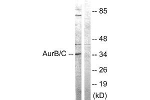 Western Blotting (WB) image for anti-Aurora Kinase B/C (AURKB/C) (Thr175), (Thr202) antibody (ABIN1848068) (AurB/C Antikörper  (Thr175, Thr202))
