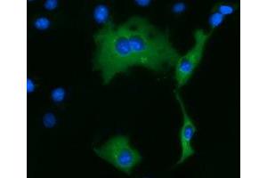Anti-KLHL2 mouse monoclonal antibody (ABIN2453208) immunofluorescent staining of COS7 cells transiently transfected by pCMV6-ENTRY KLHL2 (RC205347). (KLHL2 Antikörper  (AA 1-100, AA 494-593))