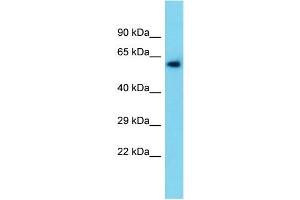 Host:  Rabbit  Target Name:  Tymp  Sample Type:  Rat Liver lysates  Antibody Dilution:  1. (Thymidine Phosphorylase Antikörper  (N-Term))