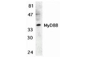 Western Blotting (WB) image for anti-Myeloid Differentiation Primary Response Gene (88) (MYD88) (C-Term) antibody (ABIN1030526) (MYD88 Antikörper  (C-Term))