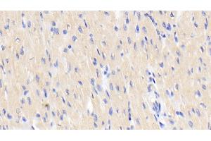 Immunohistochemistry (IHC) image for anti-Activin Receptor Type I (ACRV1) (AA 208-340) antibody (ABIN7438916)