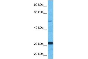 Host:  Rabbit  Target Name:  ZNF35  Sample Type:  Fetal Kidney lysates  Antibody Dilution:  1. (ZNF35 Antikörper  (N-Term))